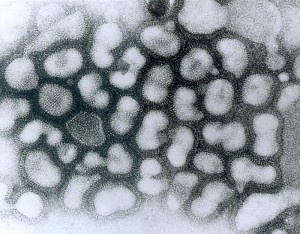 "Influenza A - late passage" by Photo Credit:Content Providers(s): CDC/ Dr. Erskine Palmer 